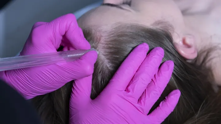 Salicylooksybrazja skóry głowy z infuzją tlenową na Śródce