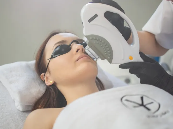 Fotoodmładzanie IPL na Śródce — anti-age światłem