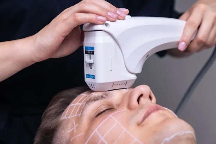 HIFU MED LIFT 3D na Śródce — lifting bez skalpela i rekonwalescencji