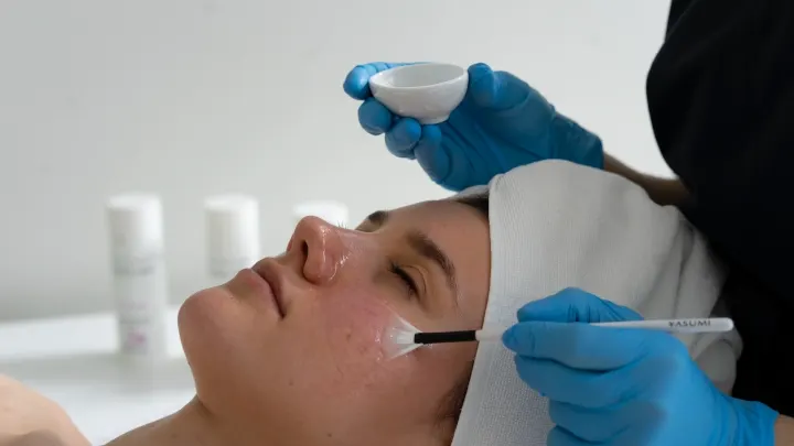 Peeling z kwasem azelainowym w Swarzędzu — terapia wyciszająca