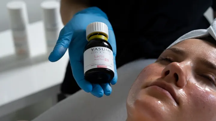 Peeling z kwasem mlekowym w Swarzędzu — na przebarwienia i suchość skóry